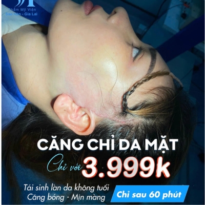 Căng chỉ da mặt uy tín tại Thẩm Mỹ Viện Sao Hàn - Gia Lai