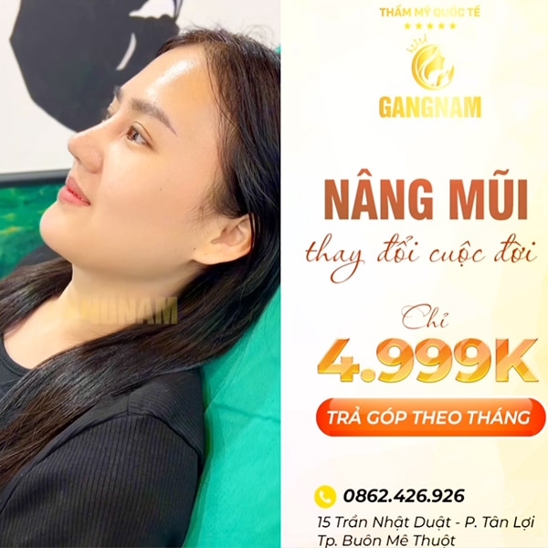 Nâng Mũi Đẹp Uy Tín Tại Viện Thẩm Mỹ Quốc Tế GangNam Korea - CN Buôn Mê Thuột