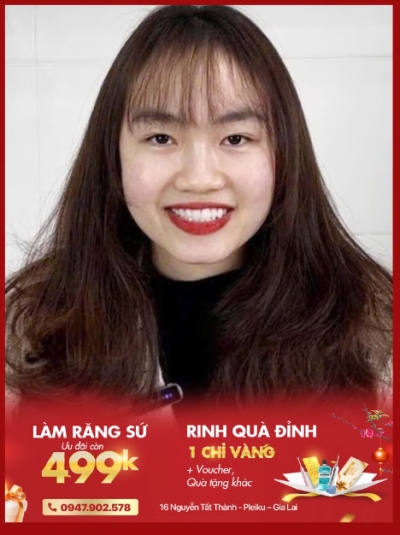 Quảng cáo facebook, quản trị fanpage cho lĩnh vực nha khoa - Nha Khoa Nụ Cười Pleiku