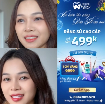 Quảng cáo facebook, quản trị fanpage cho lĩnh vực nha khoa - Nha Khoa Nụ Cười Pleiku