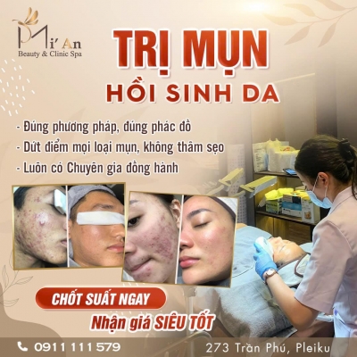 Quảng cáo facebook, quản trị fanpage cho lĩnh vực spa, thẩm mỹ - Mi'An Beauty & Clinic Spa