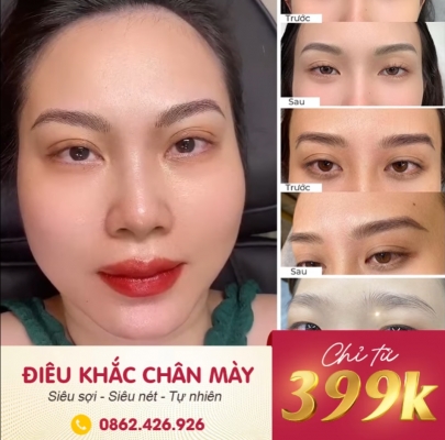 Quảng cáo facebook, quản trị fanpage cho lĩnh vực thẩm mỹ- Viện Thẩm Mỹ Quốc Tế GangNam Korea